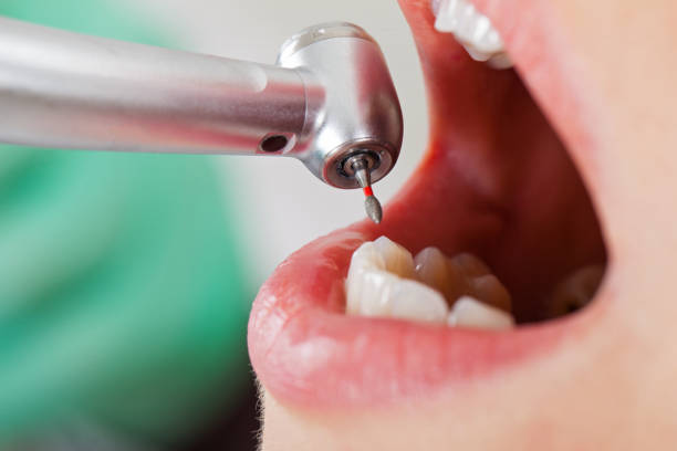 Best Emergency Dentist for Knocked-Out Tooth in Beach Park, IL